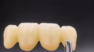 Audental 4D Master Zircônia