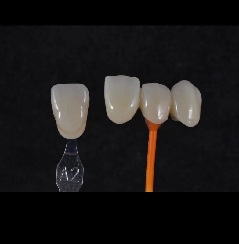 3D Pro Zirconia Dental Branco CAD CAM Bloco 98/95/92mm Sistema Aberto CE