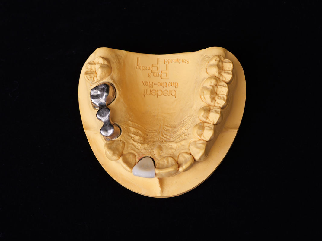 Audental 04 Noble Alloy Silver-Palladium Porcelain Alloy White Pd53.3% para restaurações dentárias de longa duração