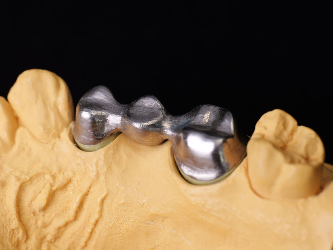 Audental 04 Noble Alloy Silver-Palladium Porcelain Alloy White Pd53.3% para restaurações dentárias de longa duração