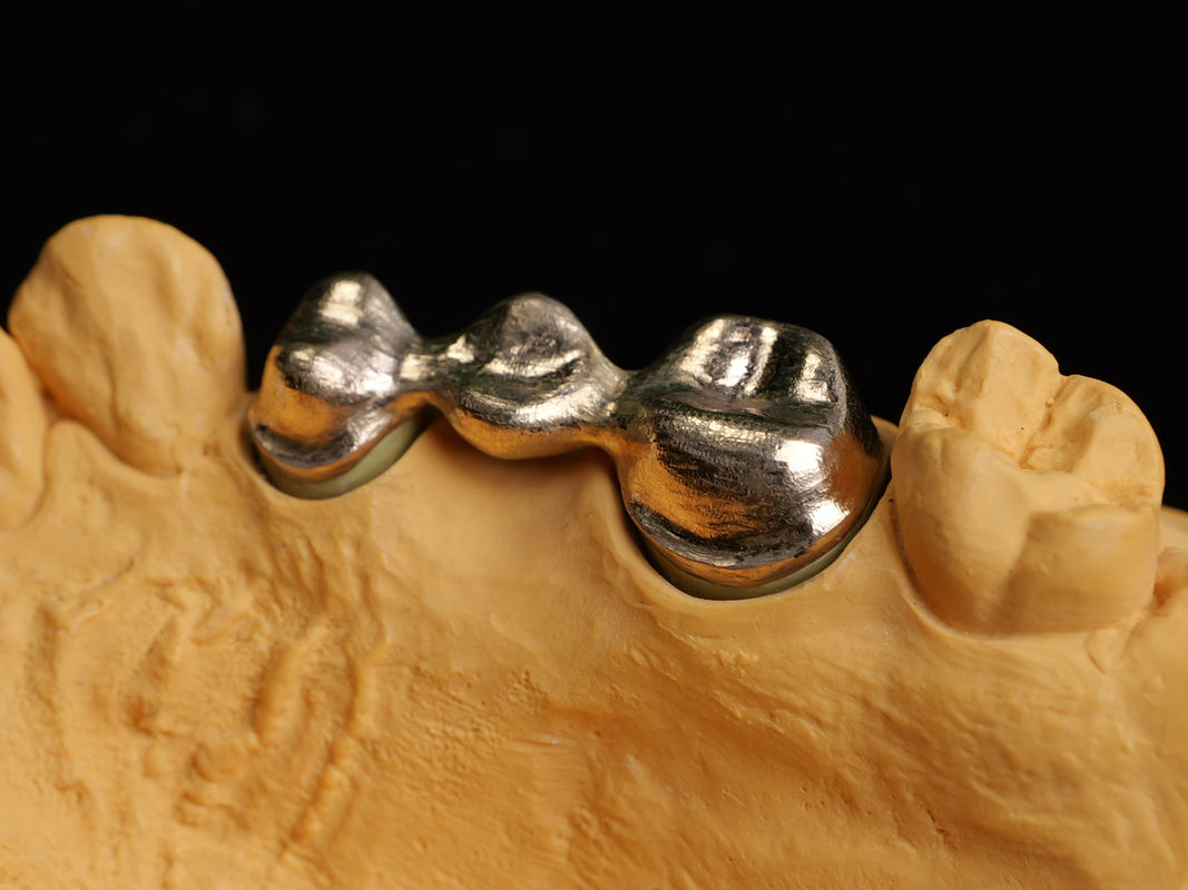 Audental 90 Restaurações Dentárias Ligação Alta Nobre, Ligação Dental Cerâmica Amarelo Au89.5%