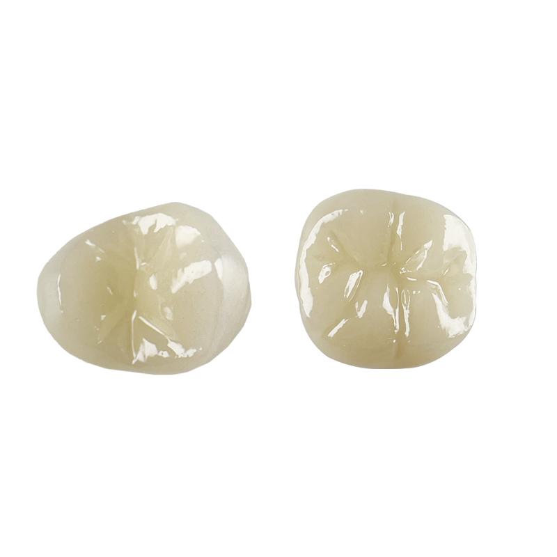Cerâmicas de Vidro Dentárias Projetadas para Precisão, Consistência e Desempenho em Facetas, Coroas, Inlays, Onlays e Pontes Anteriores